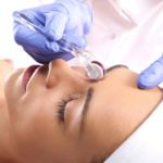Carbon Laser Facial & Microneedling Package