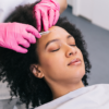 PRP Facial